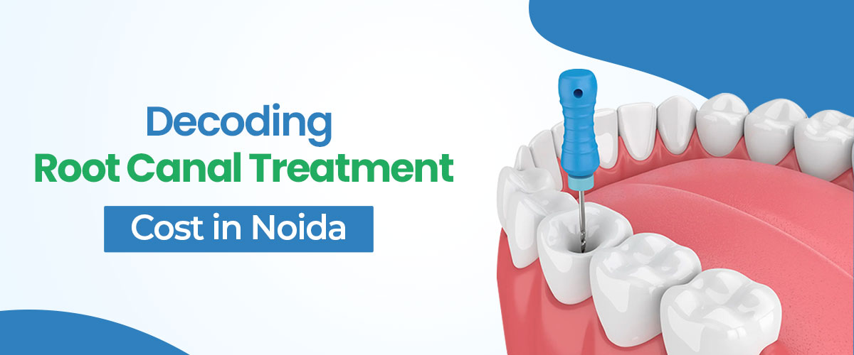 Root Canal Treatment Cost in Noida