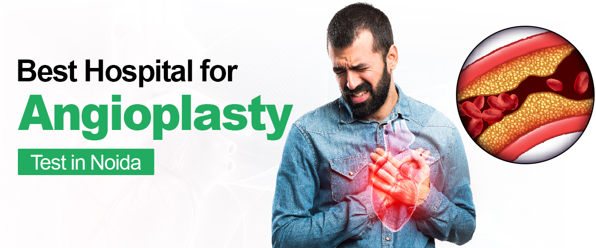 Best Hospital for Angioplasty test in Noida