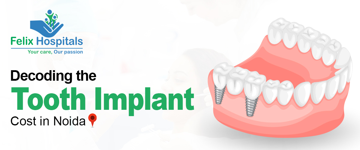 Tooth Implant Cost in Noida