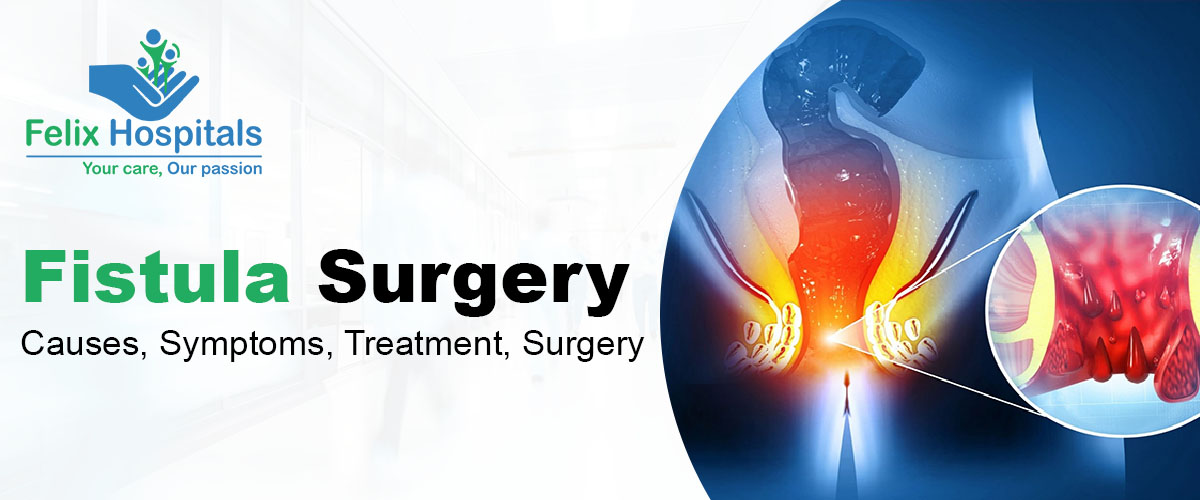 FISTULA SURGERY : CAUSES, SYMPTOMS, TREATMENT, SURGERY