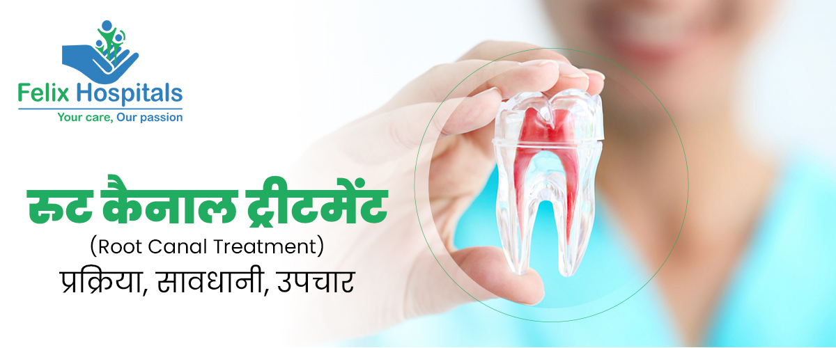 What is Root Canal Treatment