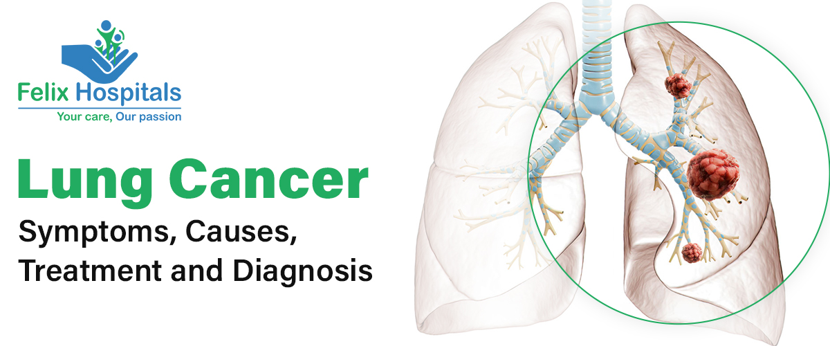 lung cancer symptoms