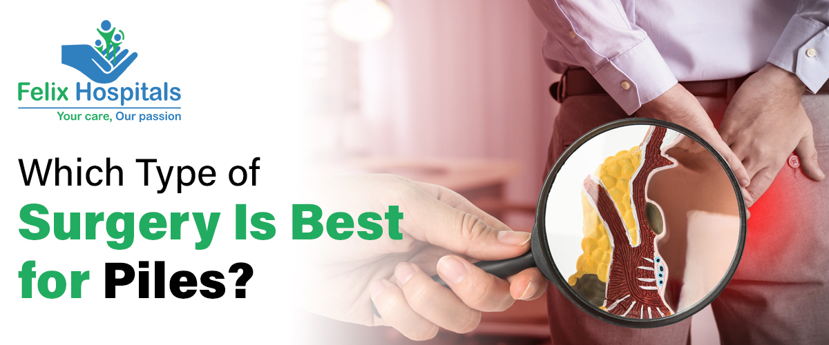 Best Hemorrhoids Surgery in Noida