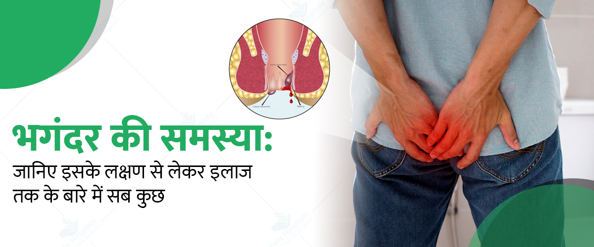 Best Treatments of भगंदर (Fistula)