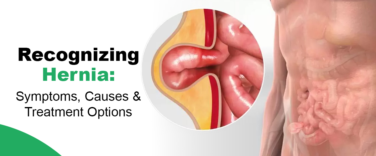 best hernia surgery in noida