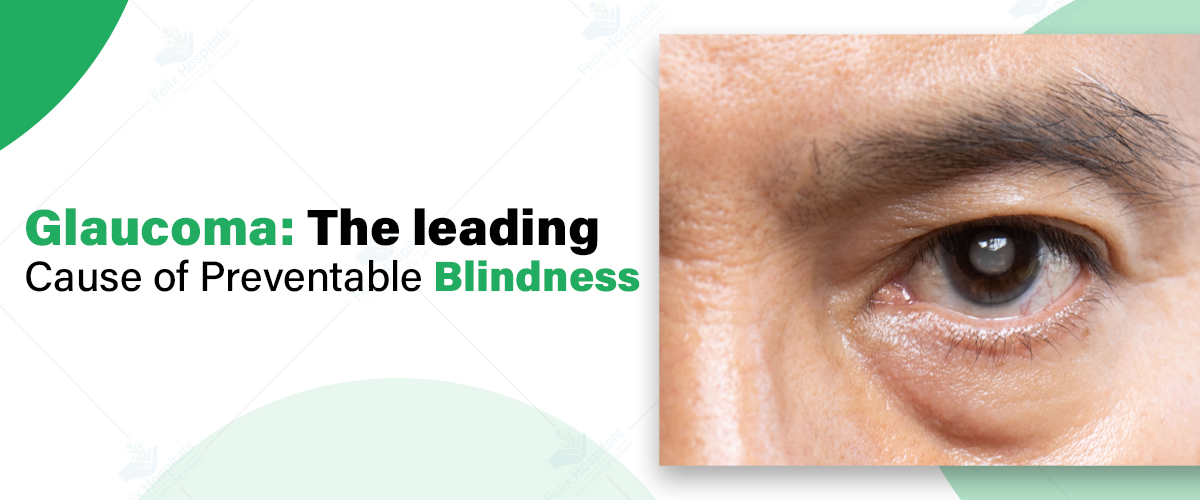 Best Glaucoma treatment noida