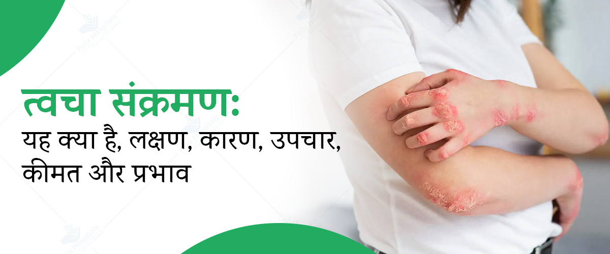 Best Hospital for skin infection treatment in noida