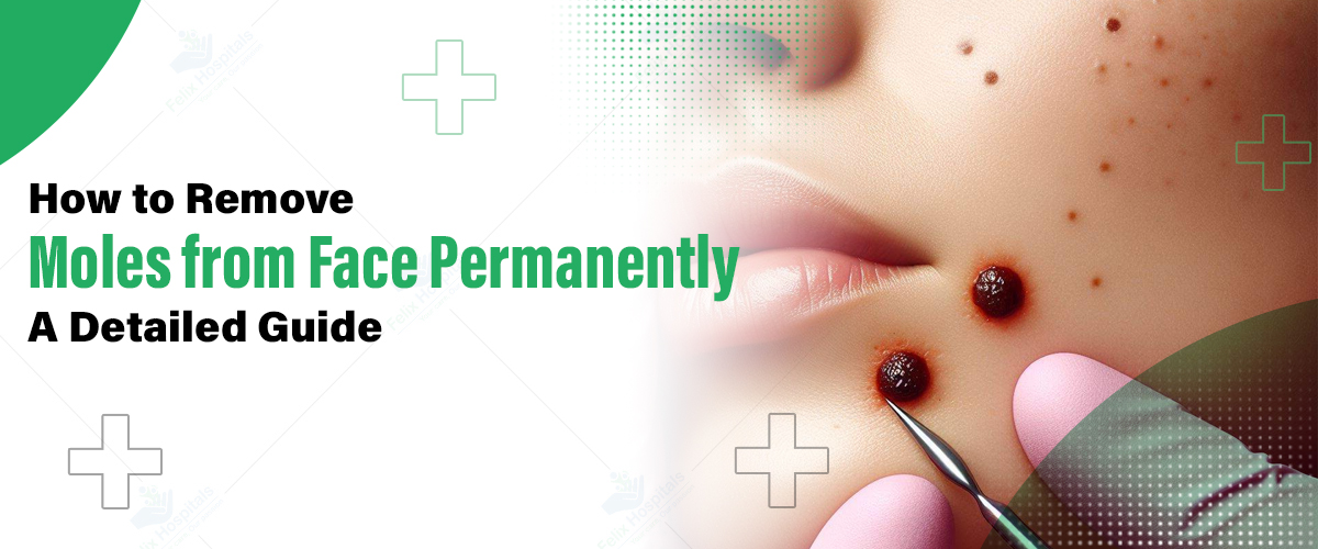 Best Hospital for Moles Removal in Noida