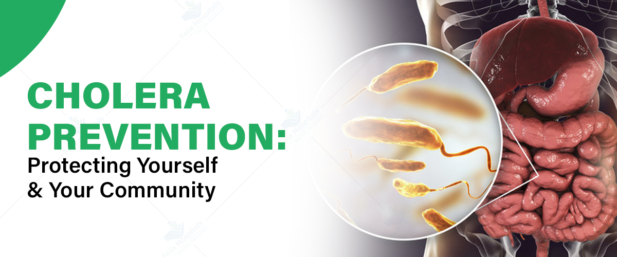 cholera prevention