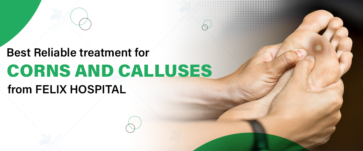 Best hospital for corns and calluses in Noida 