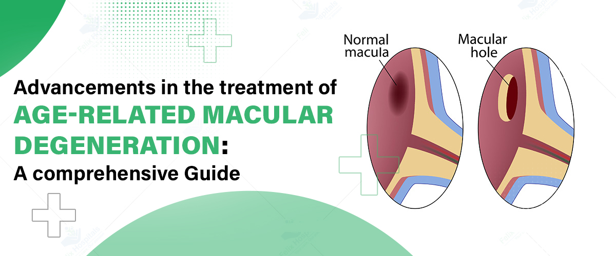  Macular Degeneration Treatment Hospitals