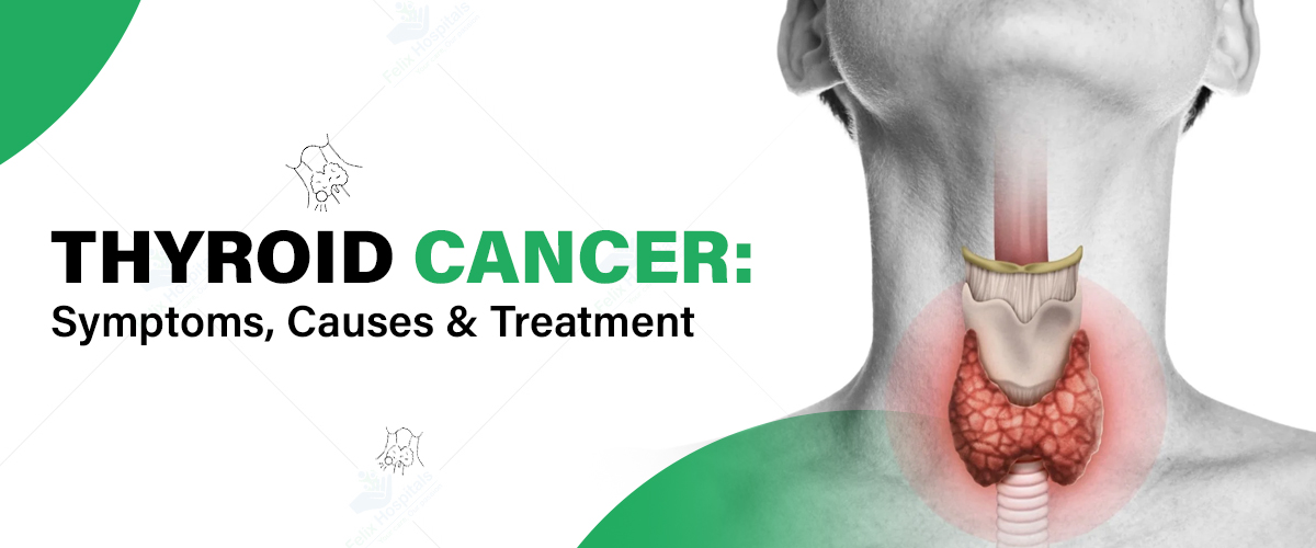 Thyroid Cancer