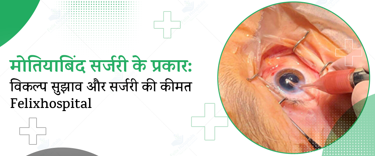 सर्वोत्तम नेत्र चिकित्सालय नोएडा में